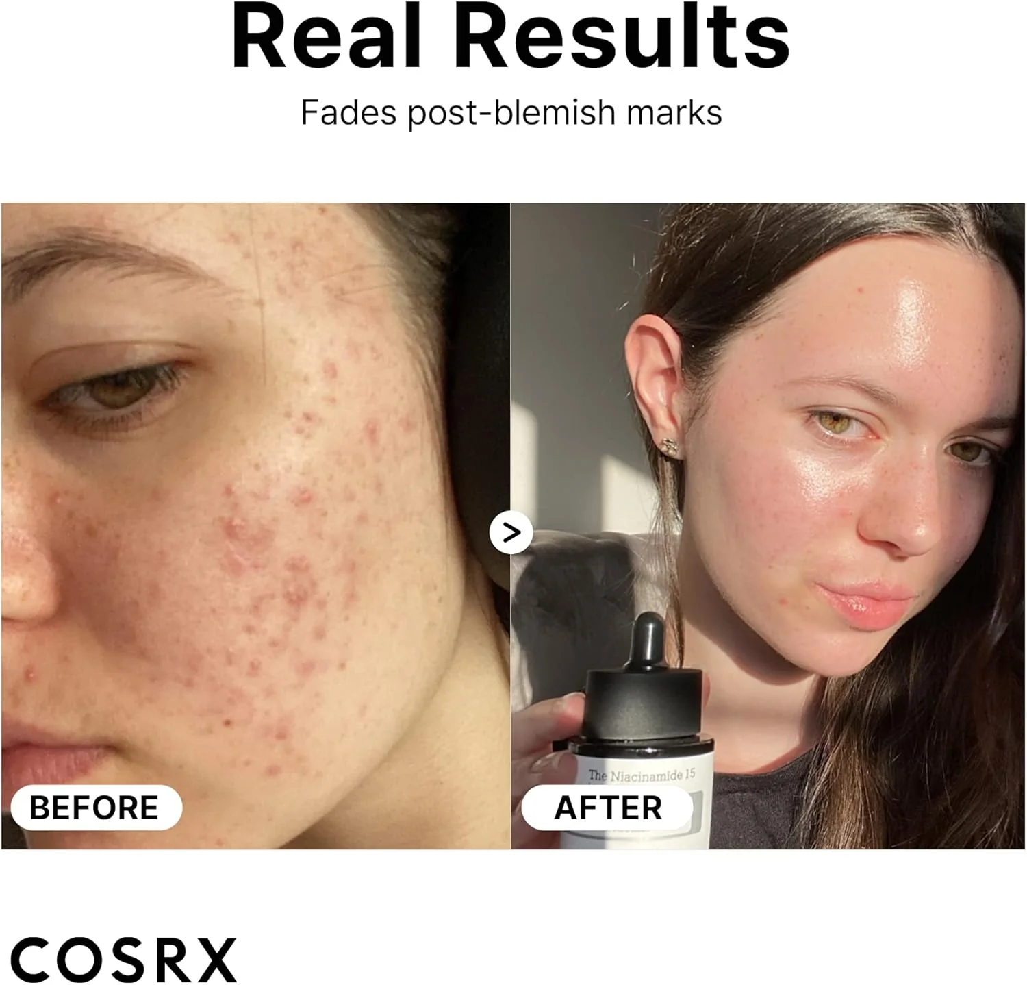 COSRX The Niacinamide 15 Serum 20ml - Image 3