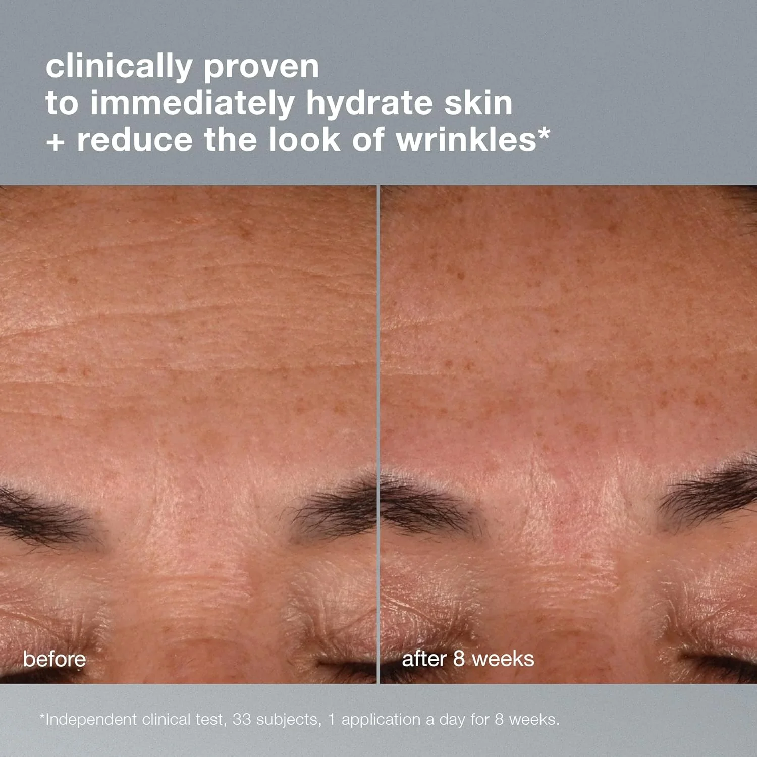 Dermalogica Age Smart Dynamic Skin-Recovery 50ml - Image 3