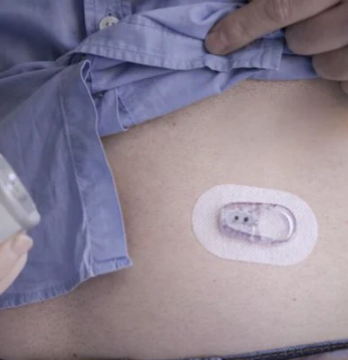 Dexcom ONE Sensor - 30 Day Supply - Image 5