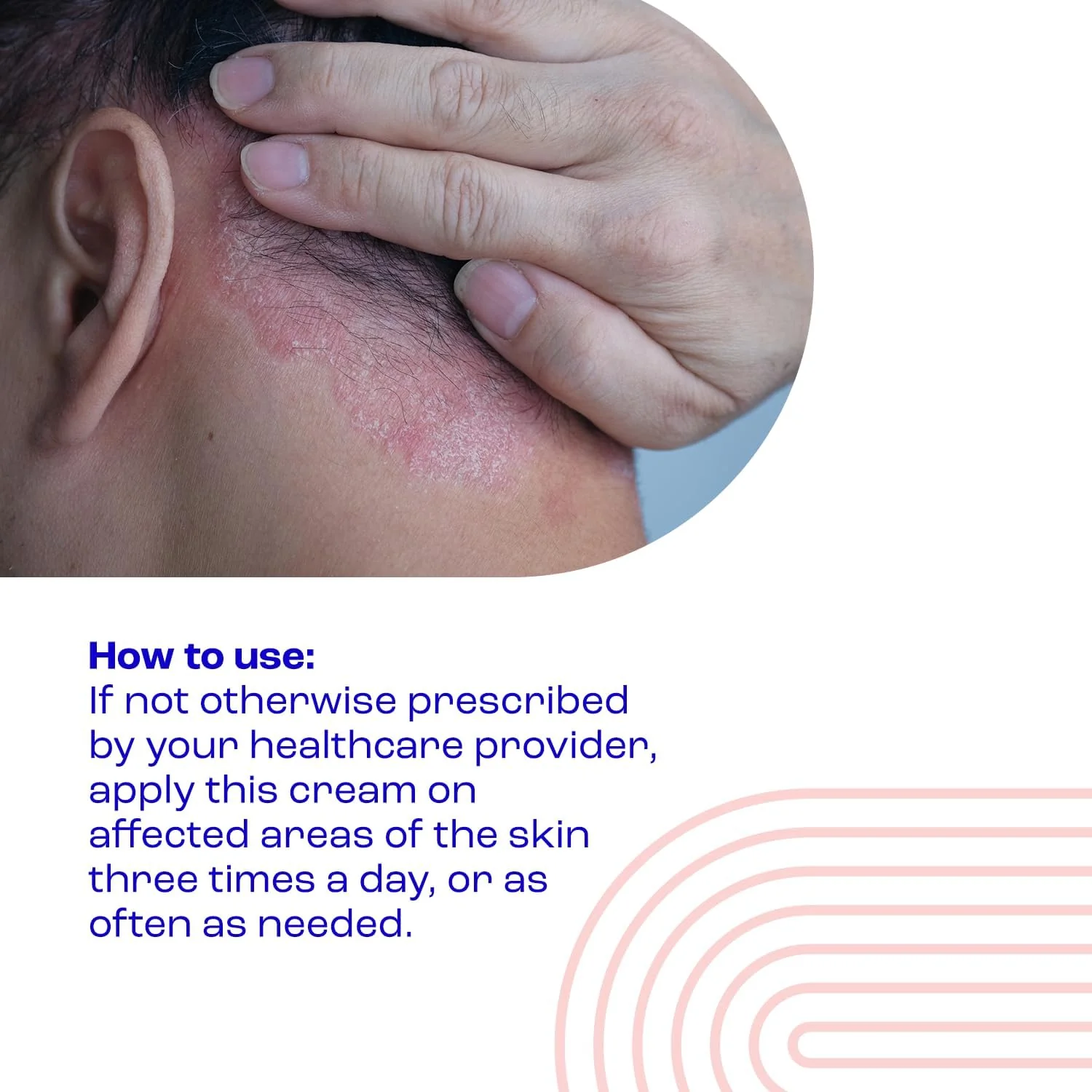 E45 Psoriasis Cream 50ml - Image 4