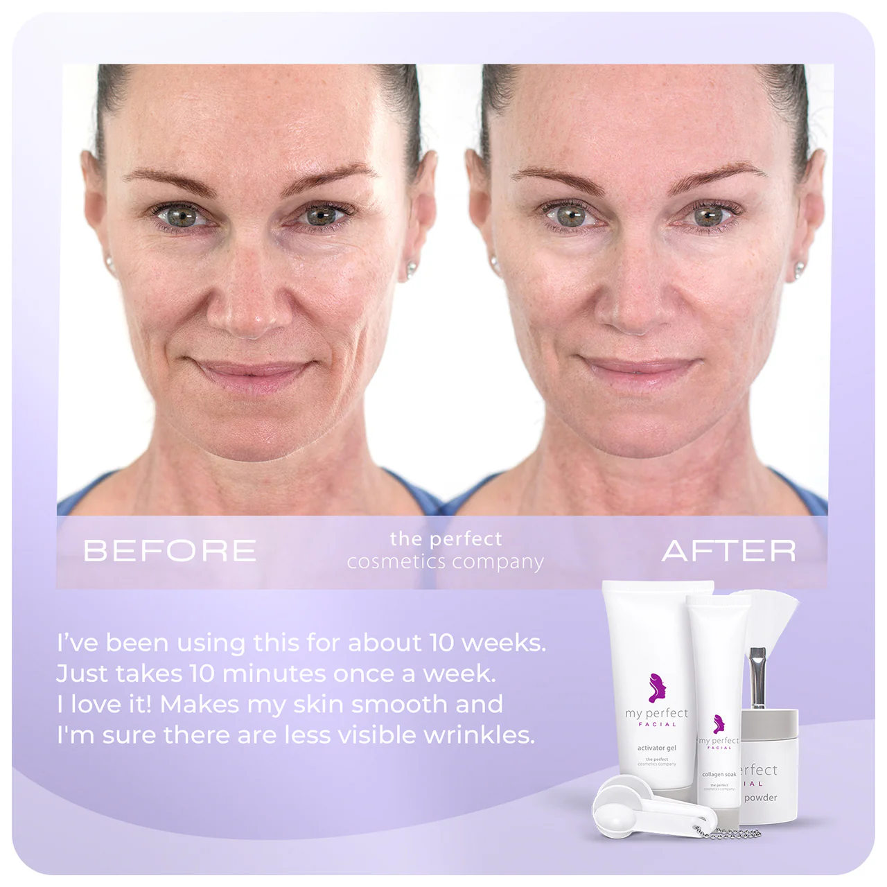 My Perfect Facial 10 Treatments - Image 2