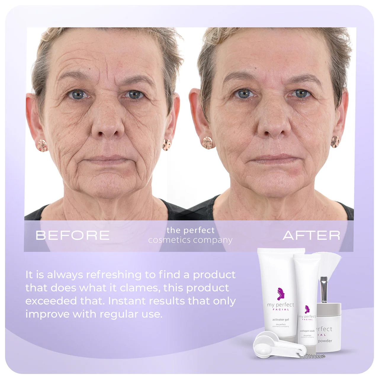 My Perfect Facial 10 Treatments - Image 4