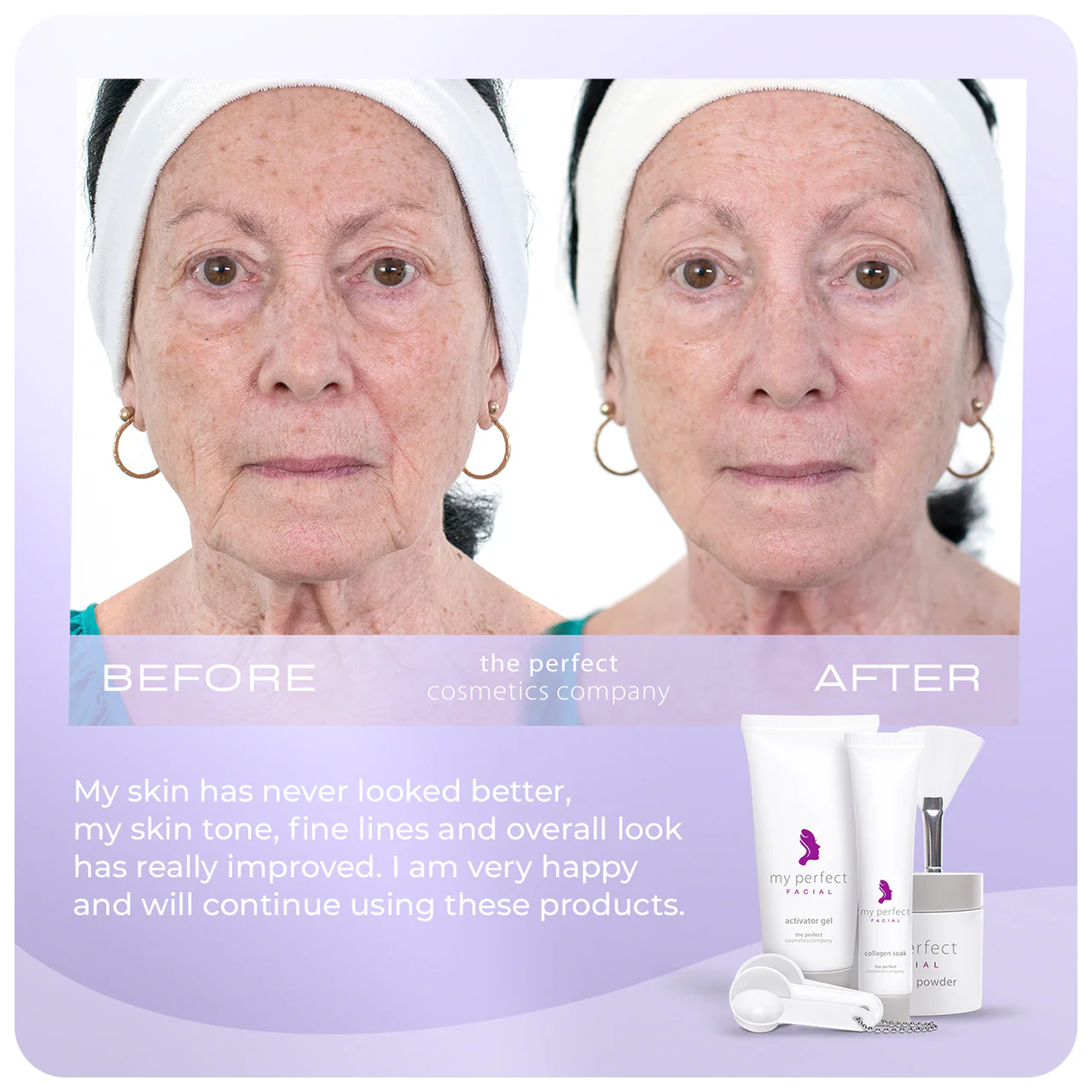 My Perfect Facial 10 Treatments - Image 5