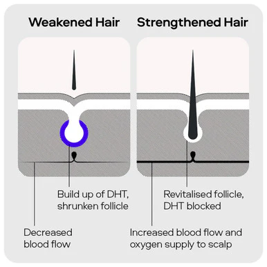 Sons DHT Blocking Hair Growth Shampoo 200ml x2 - Image 6
