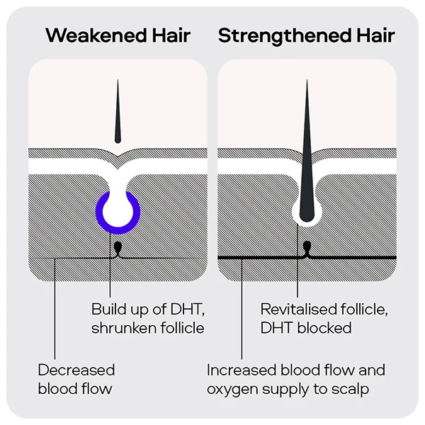 Sons Hair Loss Complete Set - Image 5